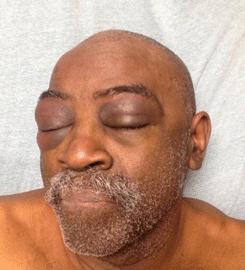 Cops Viciously Beat Deaf Man For Not Responding 
