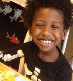 Falling Tree Limb Kills Toddler At Church Picnic