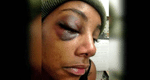 Officer Won’t Face Charges For Punching Handcuffed Woman