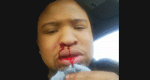 Man Said He Was Delivered From Being Gay Attacked