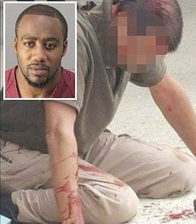 Alabama Man Charged For Pistol-Whipping Detective
