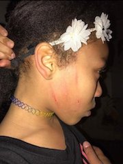 Student, 11, Handcuffed And Taken Into Custody After Bullying Led To Fight
